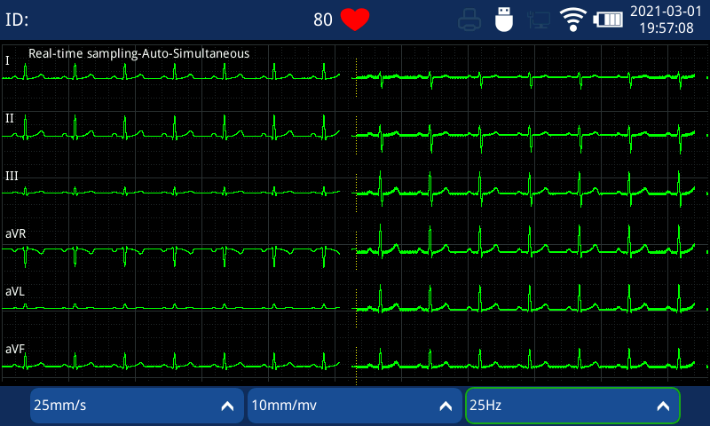 portable 3 channel EKG Machine