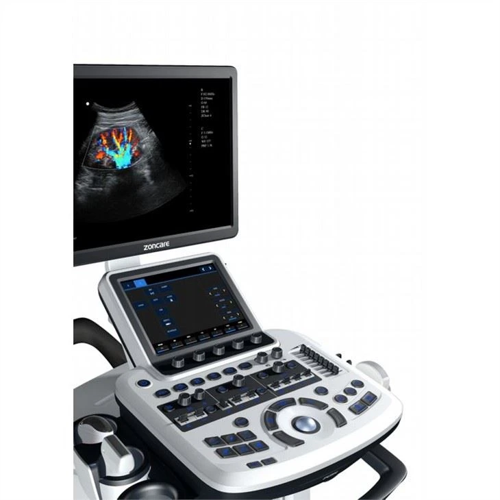 Trolley Color Doppler General Imaging Ultrasound